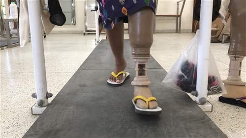 Rehabilitation and the prosthetic leg